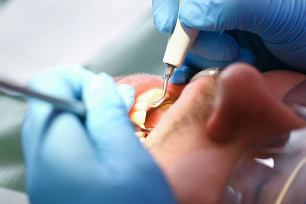 Best Knocked-Out Tooth Emergency  in East Orange, NJ